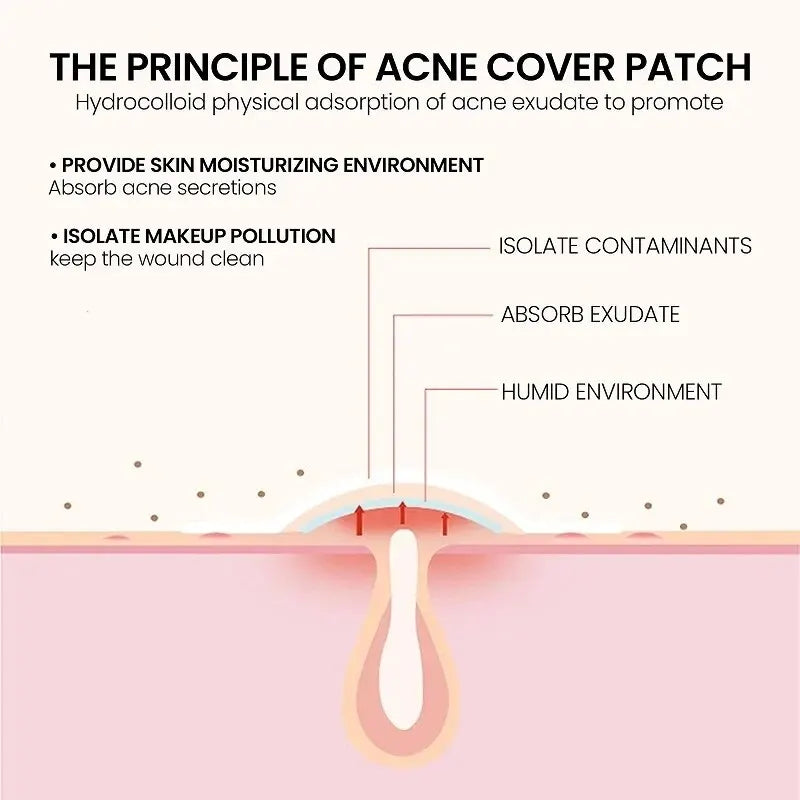 Acne Repair Patch for Blemishes & Pimple Care