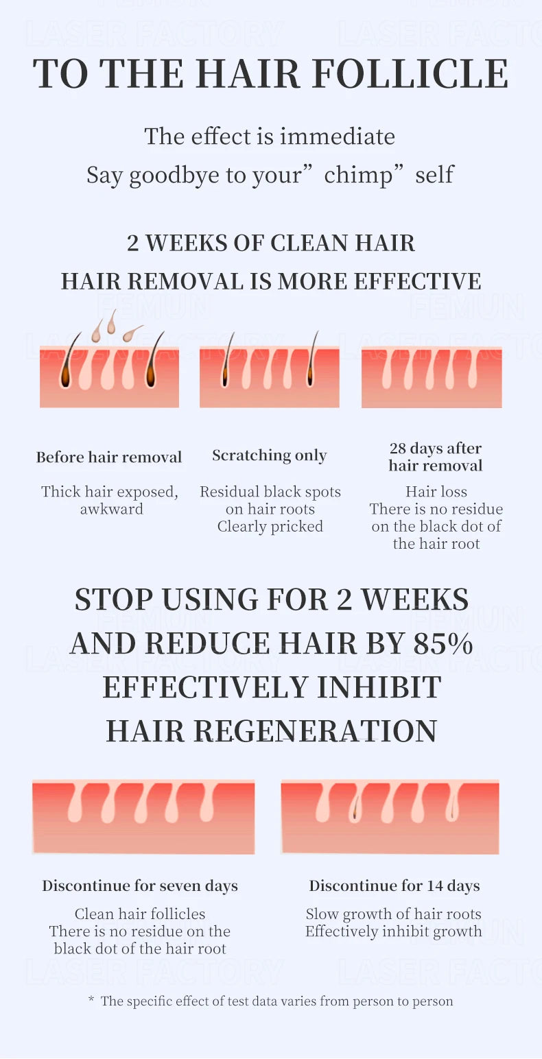 2025 Portable 808 4-Wave Diode Laser Hair Removal Device