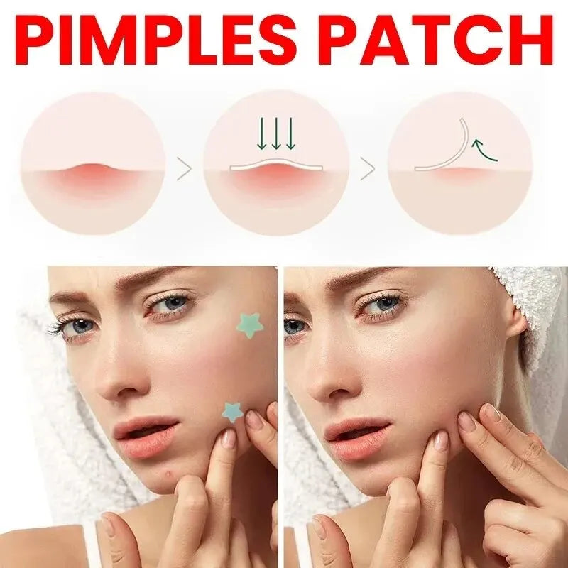 Acne Repair Patch for Blemishes & Pimple Care