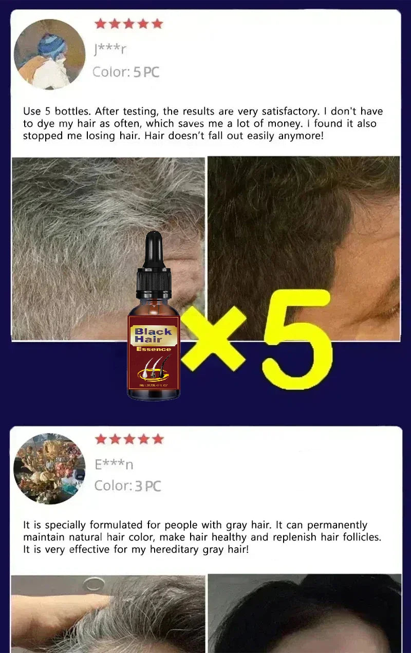White Hair Killer – Gray Hair Removal & Natural Color Restorer