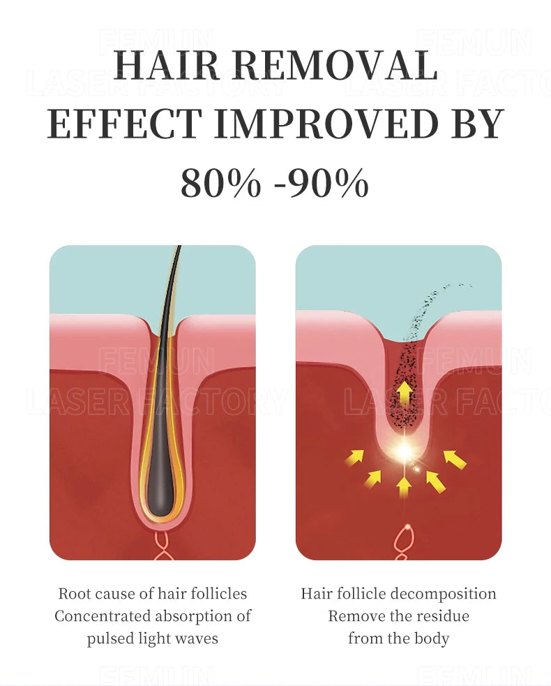 2025 Portable 808 4-Wave Diode Laser Hair Removal Device