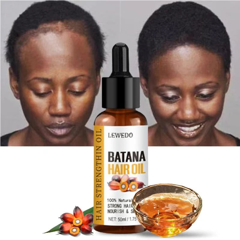 Lewedo Naturals Batana Oil – Fast Hair Growth & Nourishment