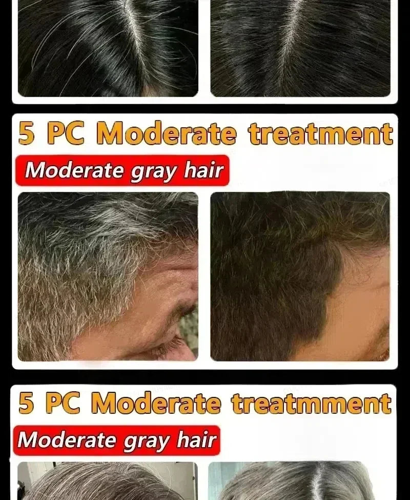 White Hair Killer – Gray Hair Removal & Natural Color Restorer