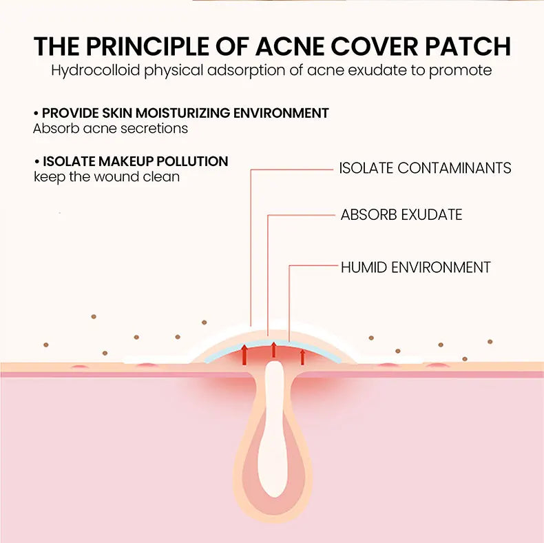 Acne Repair Patch for Blemishes & Pimple Care