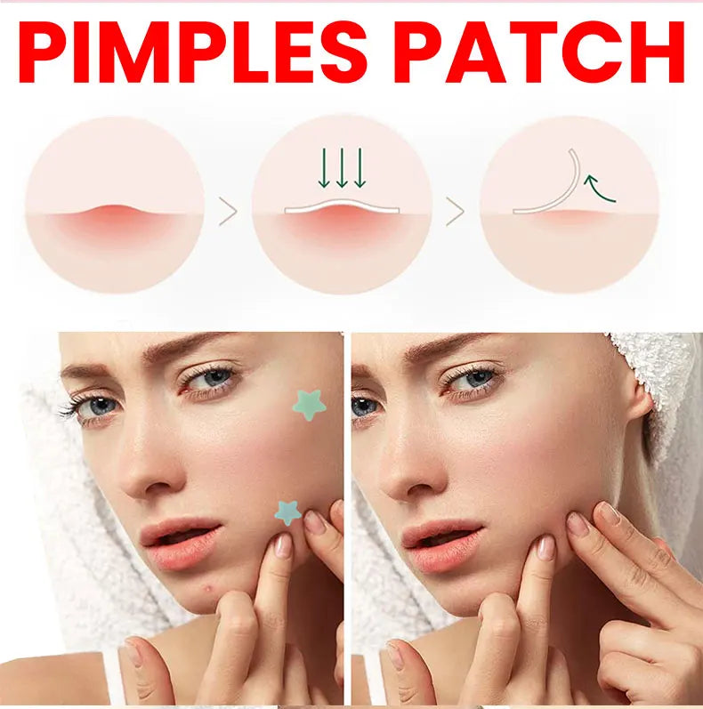 Acne Repair Patch for Blemishes & Pimple Care
