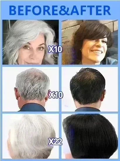 White Hair Killer – Gray Hair Removal & Natural Color Restorer